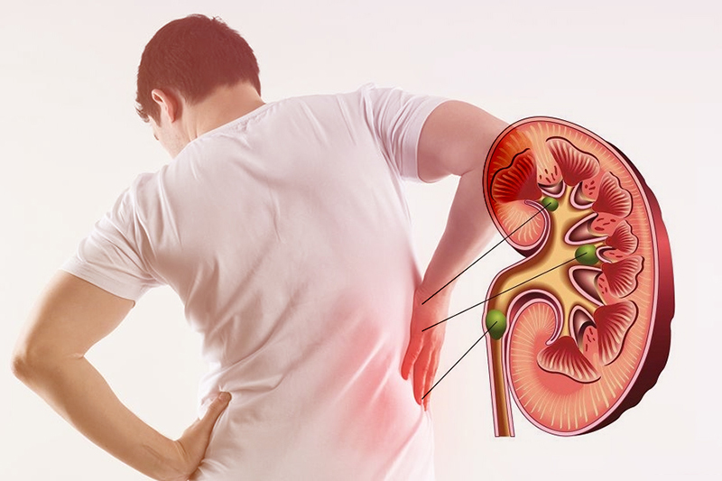 Chế Độ Dinh Dưỡng Cho Người Suy Thận Mạn – Hướng Dẫn Từ DLC Care Dĩ An 12 suy than