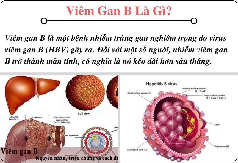 viem gan b la gi dlccare di an 1